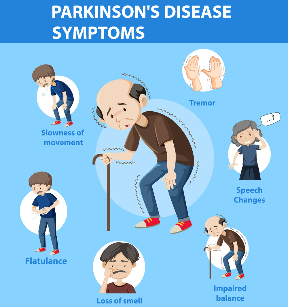 Nursing Paper Help Example on Parkinson's Disease: Unraveling the Enigma